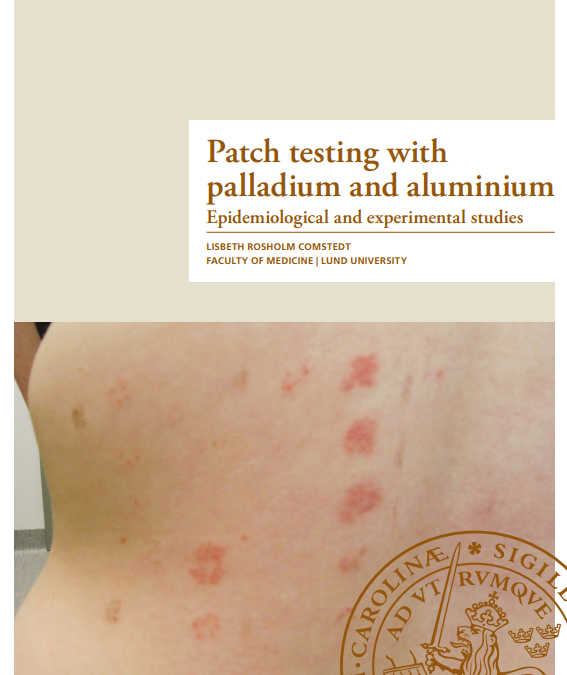 Patch testing with palladium and aluminium-Lisbeth Rosholm Comstedt